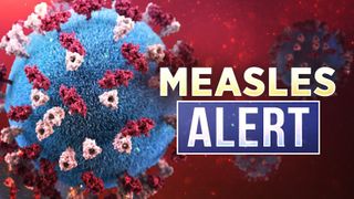  Confirmed case of measles in Southern Illinois 