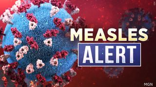  Measles case reported in central Iowa