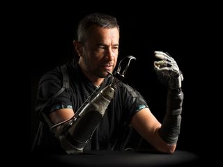 Amputees often feel disconnected from their bionic hands. AI could bridge the gap