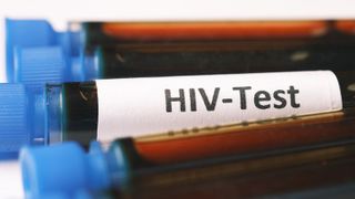  Illinois HIV funding: Black leaders call for equity as racial disparities persist