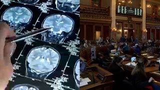 Iowa state lawmakers considering several measures to address high cancer rates