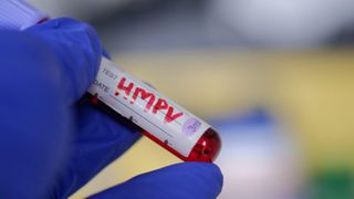 HMPV, virus with no vaccine or treatment, on the rise. Should you be worried?