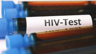  HIV myths leave women out — free testing, support available in Quad Cities