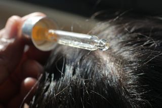 Hair growth products recalled over poisoning risk