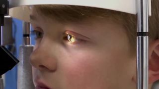  Nearsightedness: treatments to keep it from getting worse 