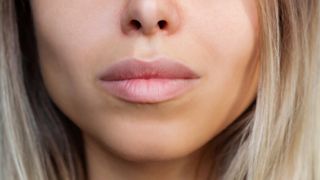 In pursuit of 'Instagram face,' are we losing the imperfections that make us human?
