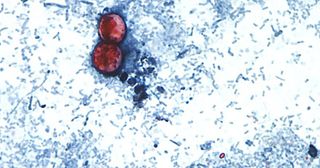 Another cyclospora outbreak not linked to lettuce under investigation: FDA