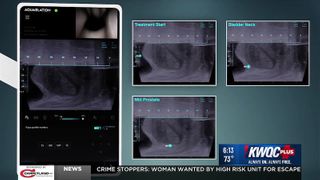  Robotic prostate treatment launches at UnityPoint-Trinity Rock Island