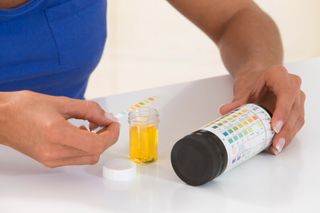 Why too many women are prescribed antibiotics for UTIs they don't have