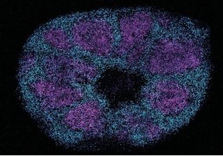 Scientists map key protein interactions linked with profound autism