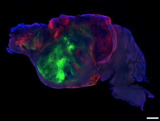 Mice with human brain cells offer a tool to study disease. Ethicists ask: What's next?