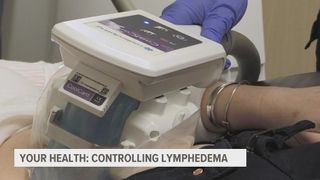 Controlling Lymphedema with bypass surgery