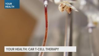 Treating Non-Hodgkin lymphoma with CAR T cell therapy